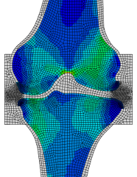 Slice through the knee showing the bone density distribution predicted by the model.